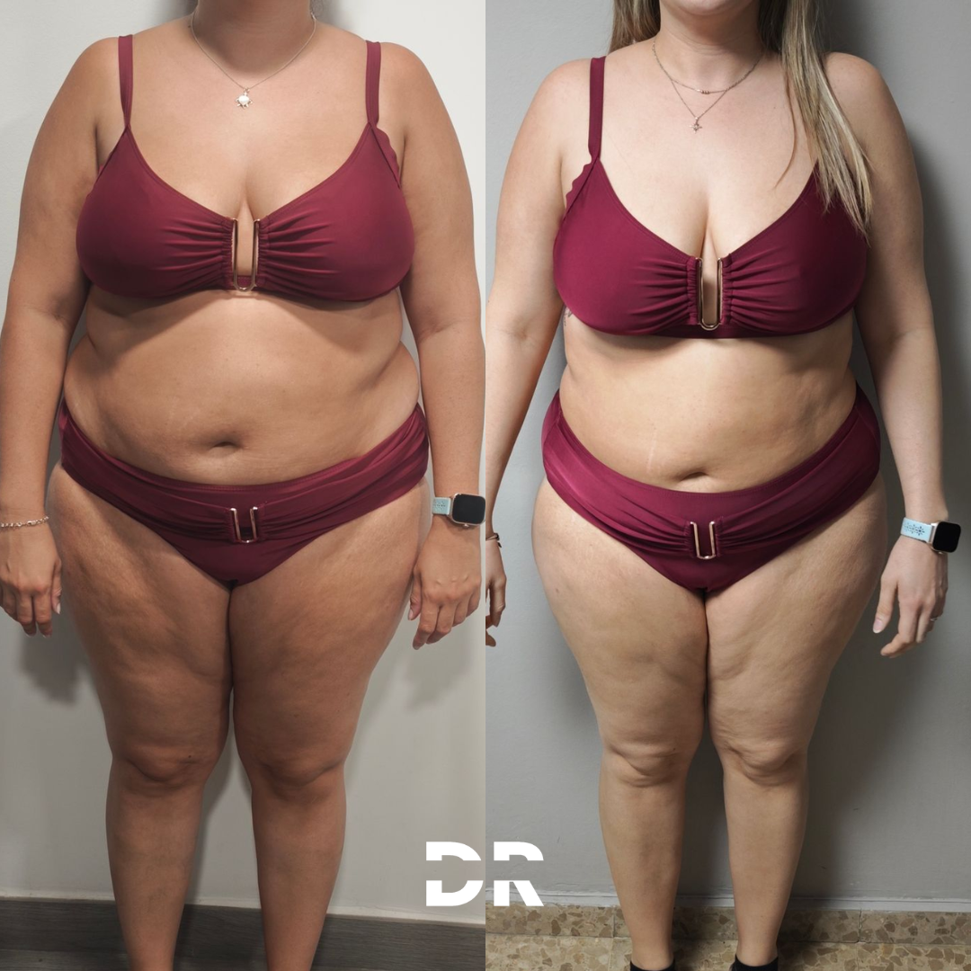 Transformación de una clienta del programa